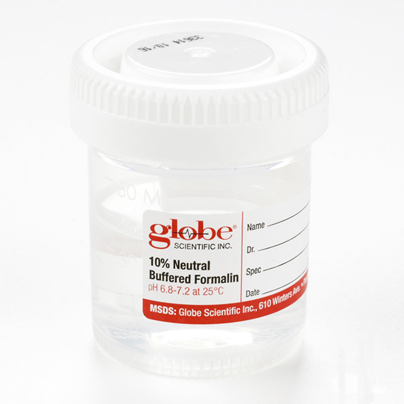 Large Biopsy Bottle (60ml) Bridge Dermpath